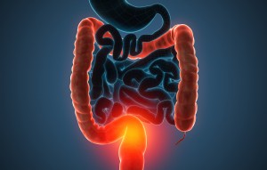 shutterstock_359258204coloncancer