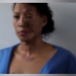 Mujer-ataque acido